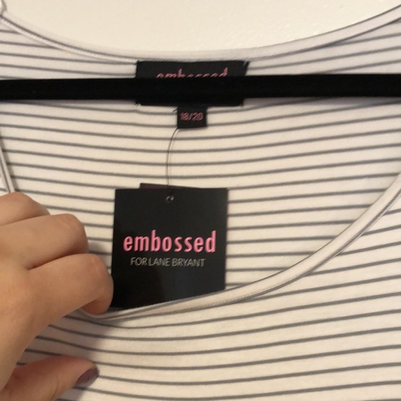 Striped tunic - Picture 3 of 3